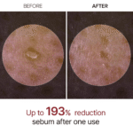 پیل شات دکتر ملاکسین - Image 2