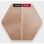 سرم لایه بردار Skin1004 - Image 2